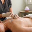 Acupuncture