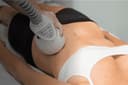 Cellulite Reduction