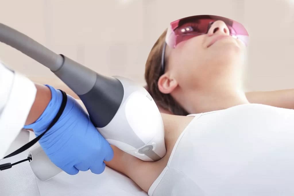 Laser Hair Removal in Burnaby
