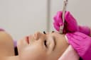 Microdermabrasion