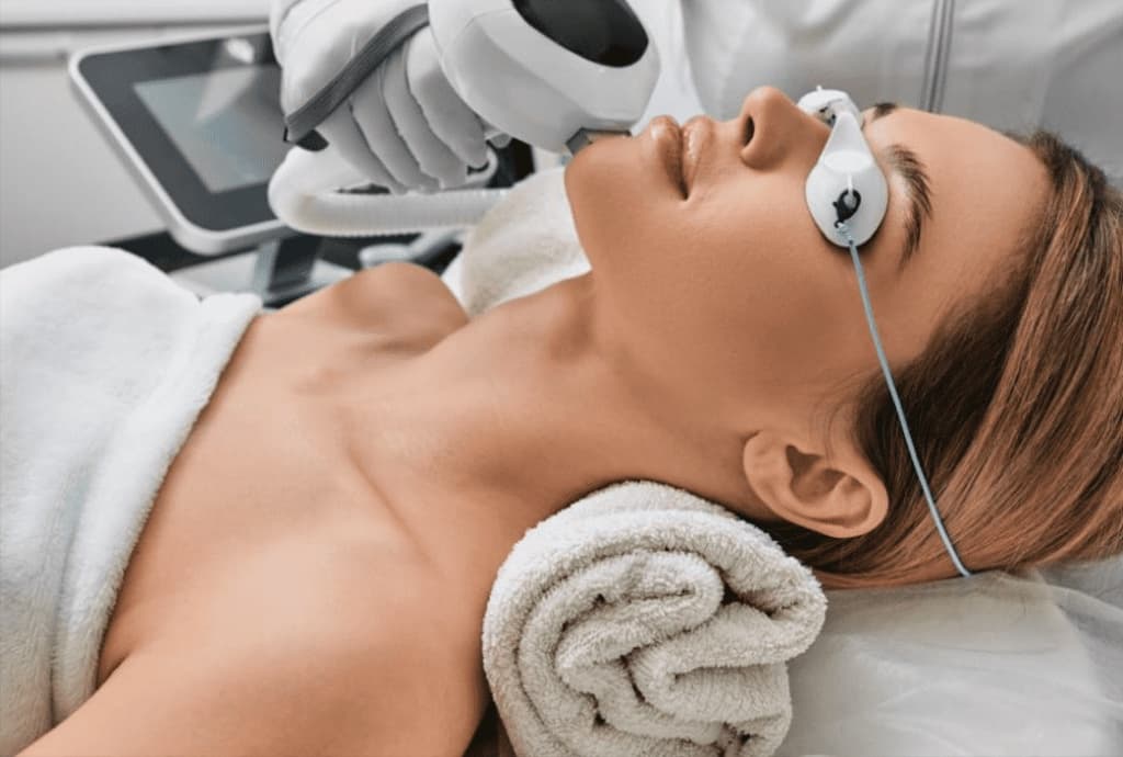 Lumecca IPL Photofacial in Burnaby